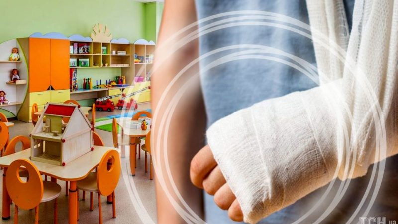 Скандал у дитсадочку в Житомирі: дитина ледь не зламала руку, батьки шукають винних серед вихователів